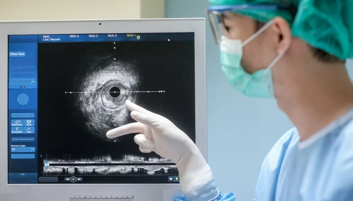 Advanced Philips Epiq CVx Cardiac Ultrasound